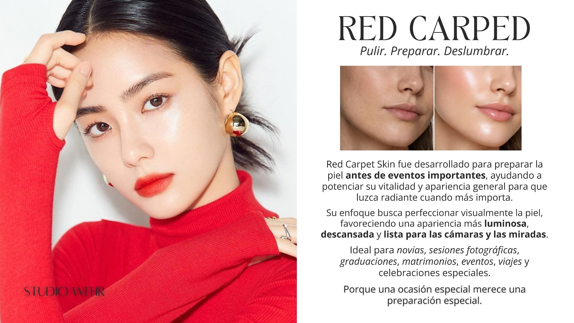 Red Carpet Skin en Studio Wehr
